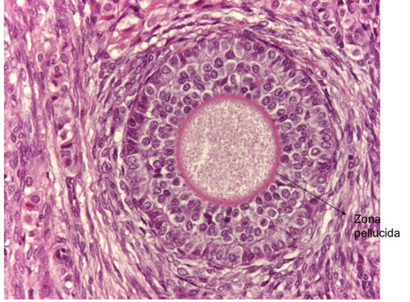 <p>what type of follicle?</p>