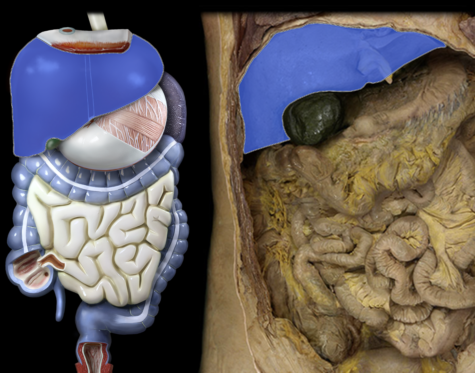 <p>The first component of the urinary system is _______ which ______ blood. It _______ waste products and _______ filtrate into urine </p>