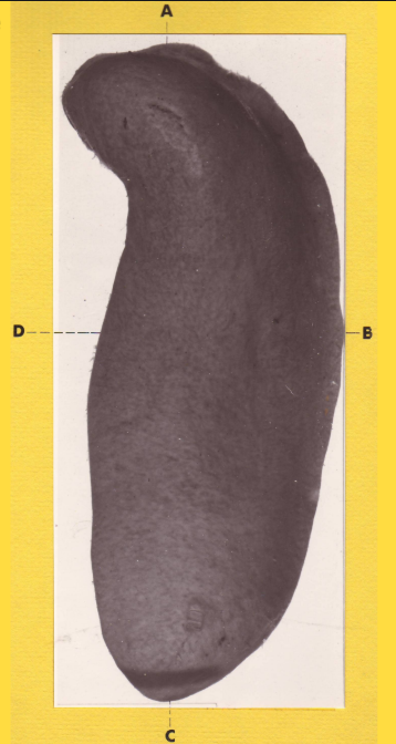 <p>What is B?</p>