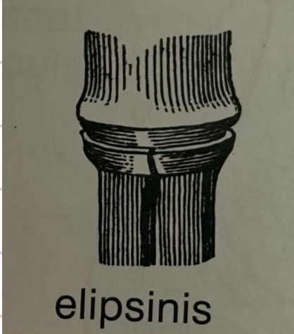 <p>Articulatio ellipsoidea</p>