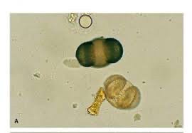 <p>What type of parasite is this?</p>