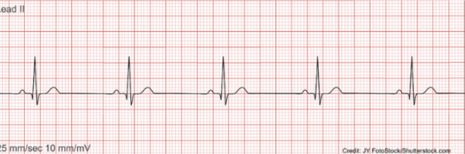<p>Identify the rhythm! Discuss nursing and collaborative care</p>