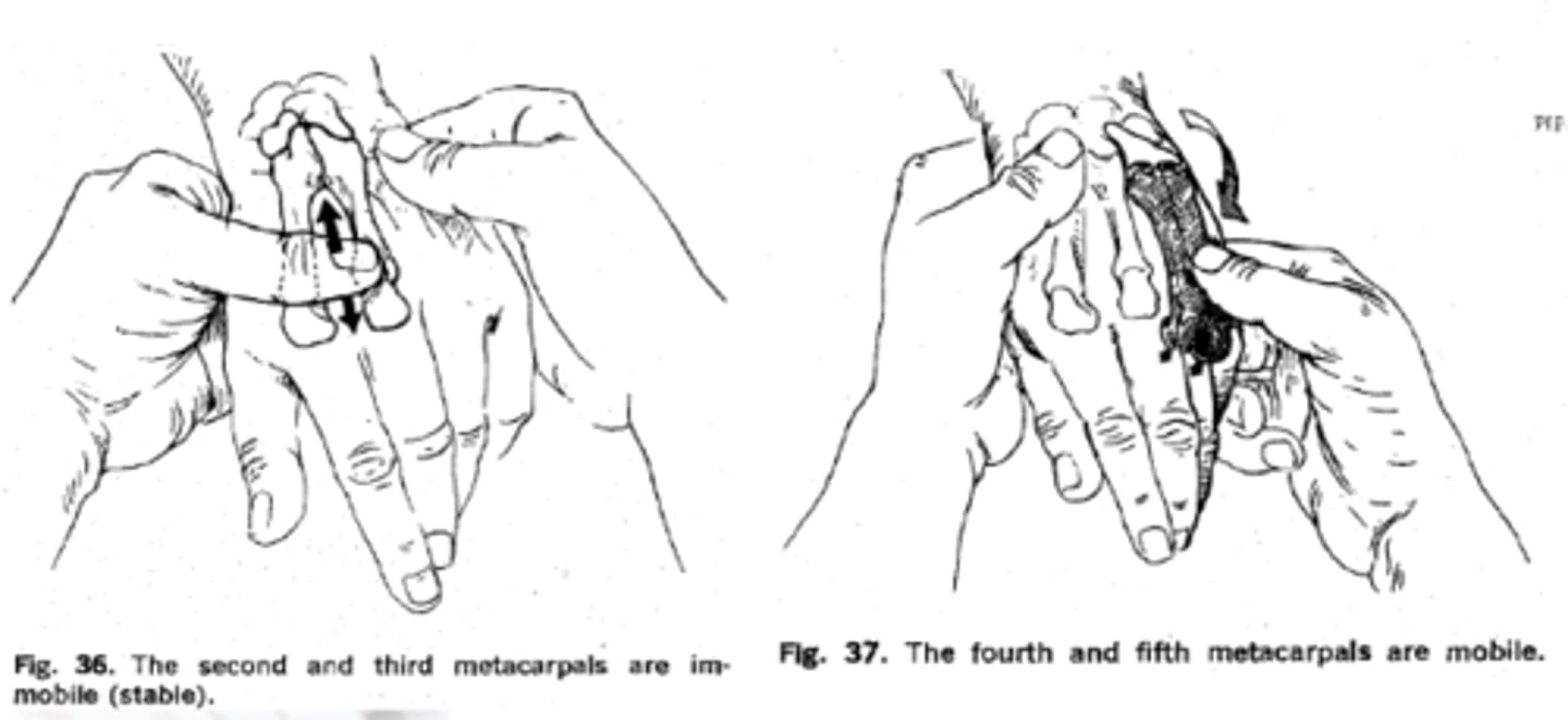 <p>- metacarpus II, III. > stabilak, finom mozgások!</p><p>- metacarpus IV, V. > mobilak, erős szorítás!</p><p>- MCP sor (flexiókor előtűnik)</p><p>- PIP, DIP > nyomásérzékenység, duzzanat van-e</p>