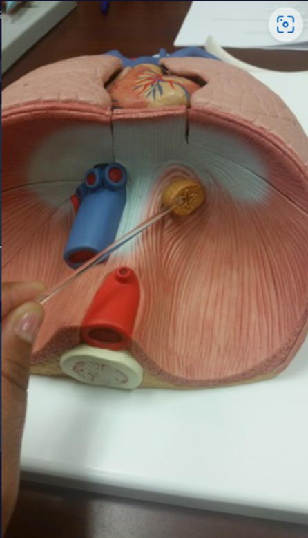 An opening in the diaphragm where the esophagus passes through.