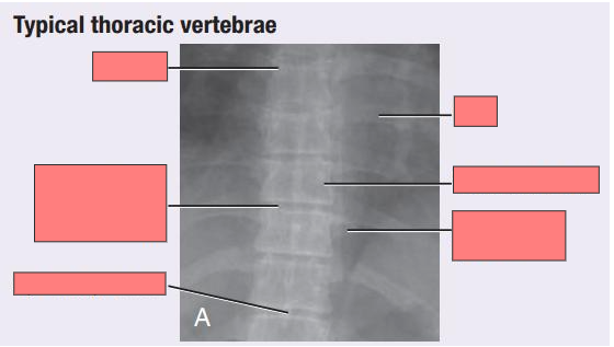 Back: Regional Anatomy -> Ligaments (pg. 36-47) Flashcards 