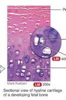 <p>resilient gel are ground substance, bluish-white, shiny, prominent chondrocytes in cartilage lacunae surrounded by perichondrium (except joints, growth plates, where bone lengthen); end of long bones, anterior end of ribs, nose, larynx, etc.; smooth surface for movement at joints, flexibility, and support</p>