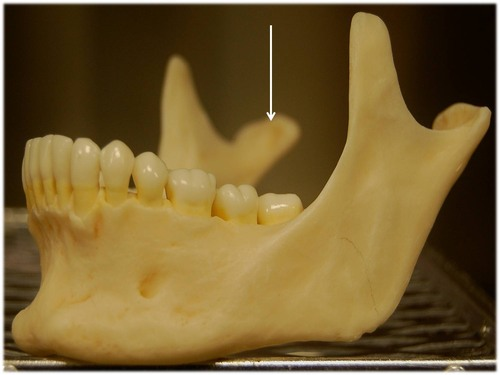 <p>Articulation point of the mandible with the mandibular fossa of the temporal bone</p>