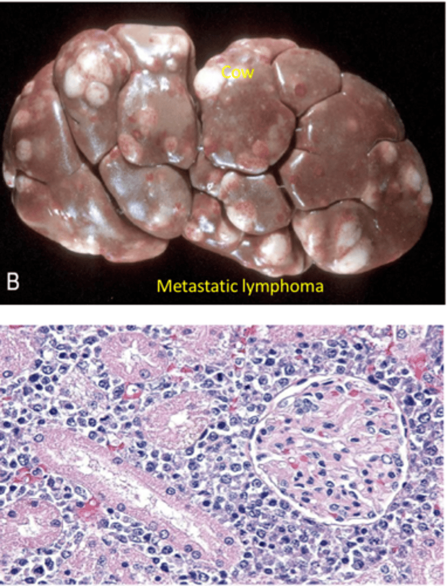 <p>Malignant tumor of lymph nodes and lymph tissue</p><p>Primary or metastatic can impact kidneys</p>