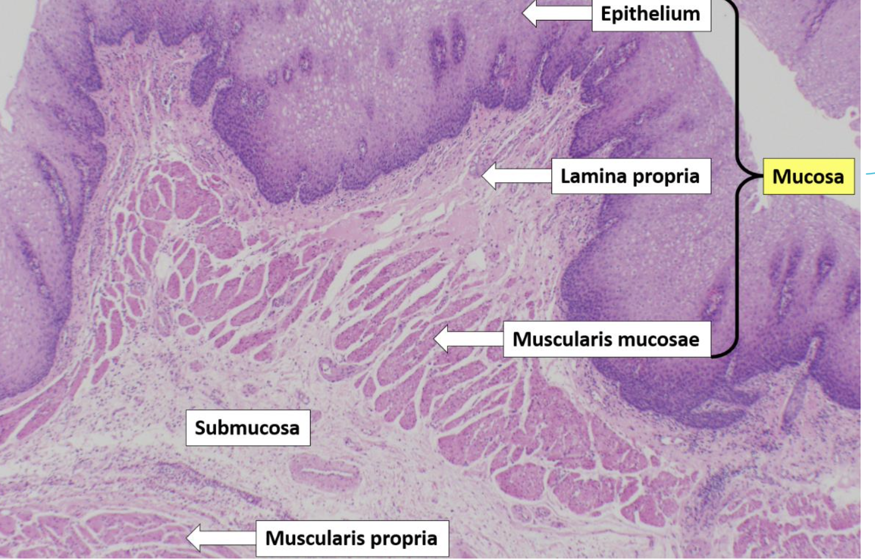 **Muscular tube, which transports swallowed material from the pharynx to the stomach** 