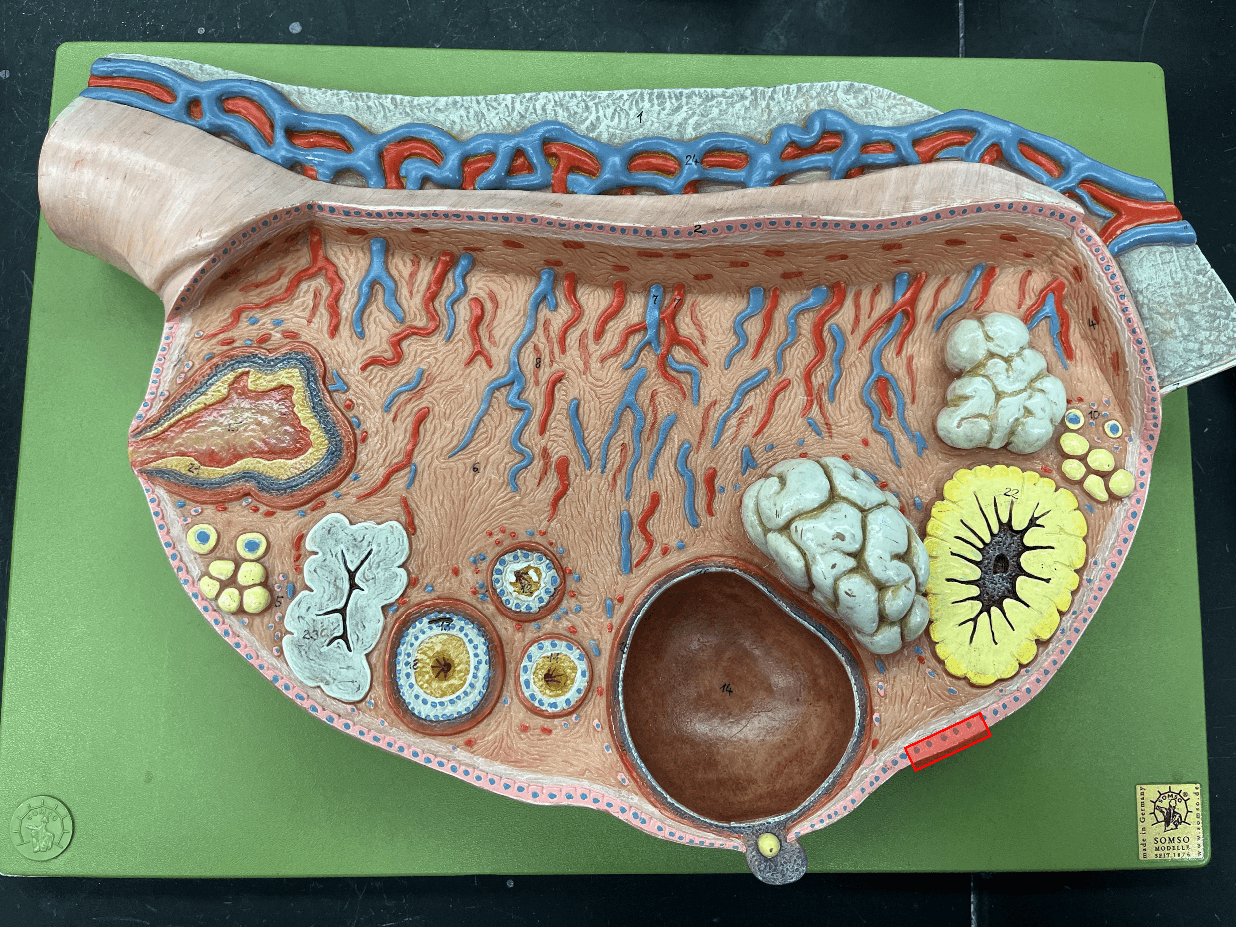 • Part of the ovary.

• A layer of simple cuboidal epithelium externally covering the tunica albuginea.