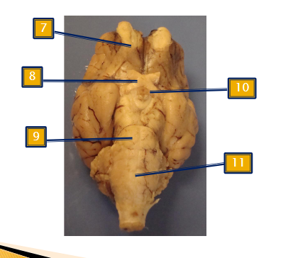 <p>Inferior View</p>