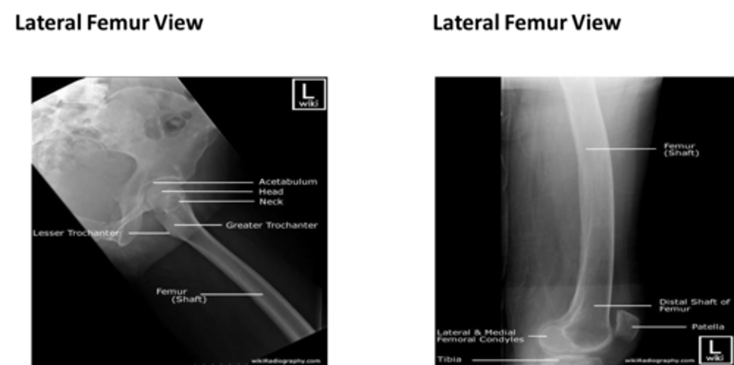 <p>- to include the entire length of the femur and lateral soft tissue borders. The knee and hip joint must also be included.</p>