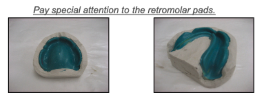 <p>- Sit flat on the bench top.</p><p>- Have their mean foundation planes parallel to the bench top.</p><p>- Have a matrix material land area, about 10 mm wide around the impression.</p><p>- Have the peripheral rolls of the impression extend up about 5 mm above the land area (don’t forget the lingual rolls).</p><p>- Pay special attention to the retromolar pads.</p>
