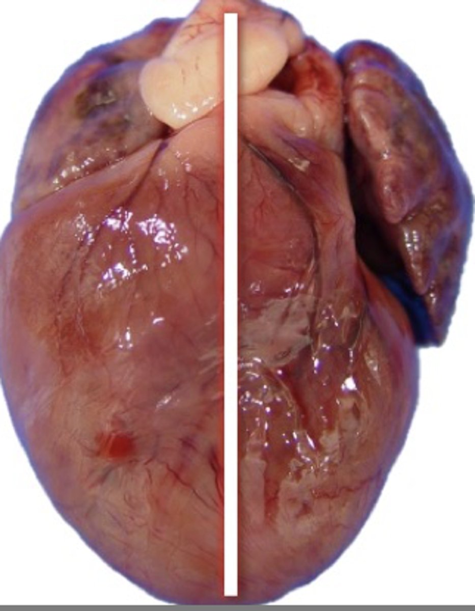 <p>If a patient has a heart that is gross in appearance as shown in the picture, what are some underlying causes? (Multiple answers apply)</p><p>A. Mitral valve disease</p><p>B. DCM</p><p>C. Aortic stenosis</p><p>D. Pulmonary hypertension</p><p>E. HCM</p><p>F. VSD</p><p>G. Pulmonic stenosis</p>