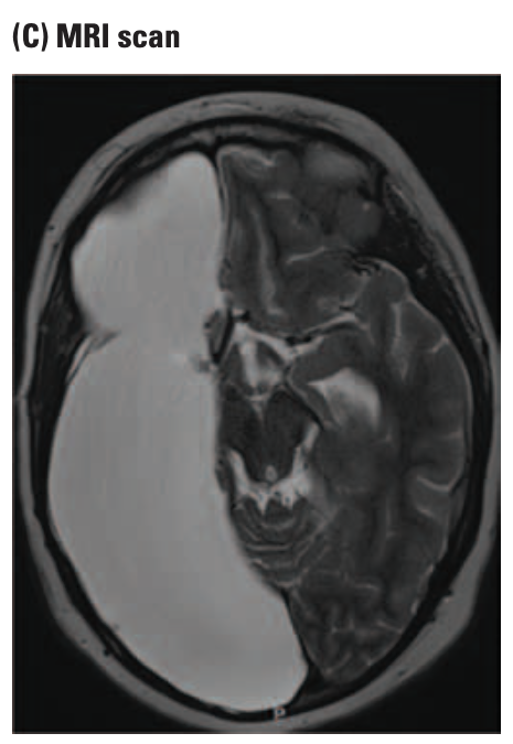 magnetic resonance imaging (MRI)