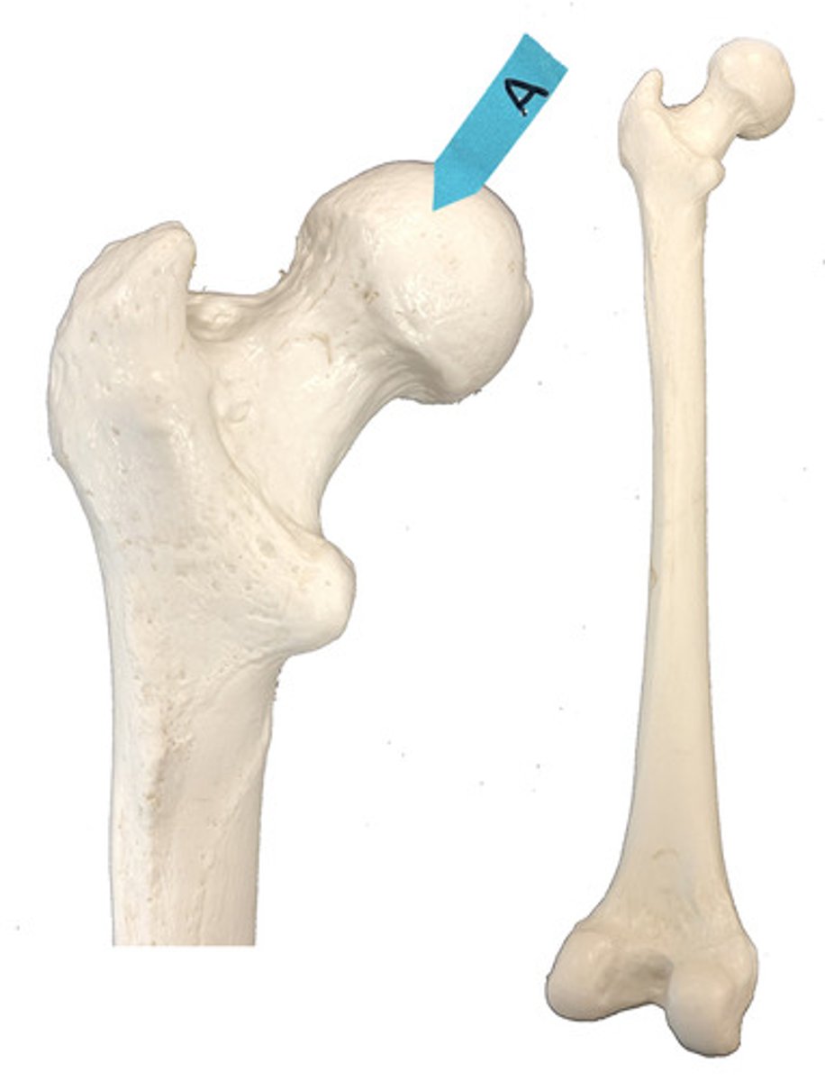 <p>Identify this bone marking.</p>