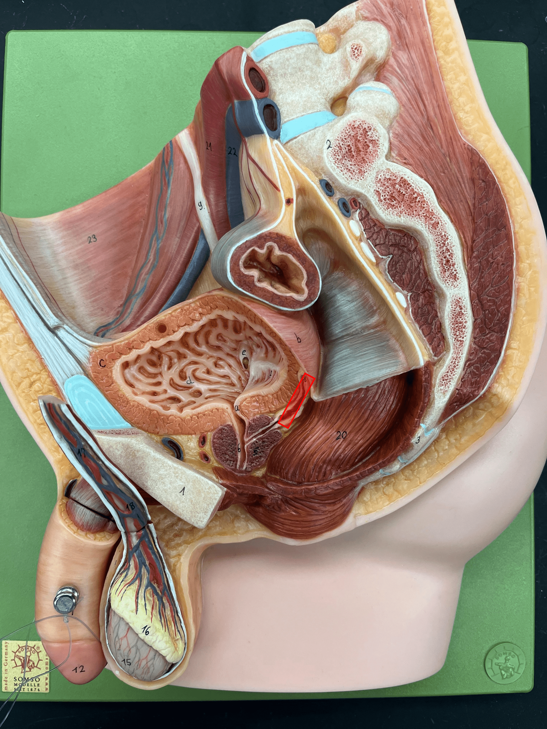 • Part of the ductus deferens.

• A broadening of the ductus deferens just before the ejaculatory duct.