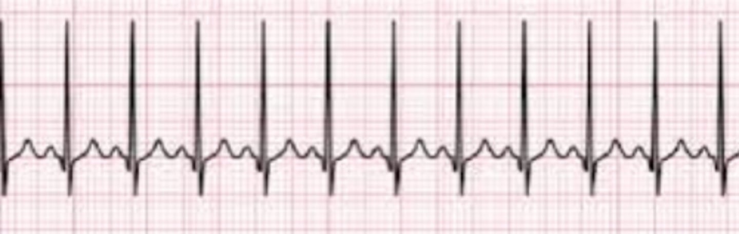 <p>Name the rhythm</p>