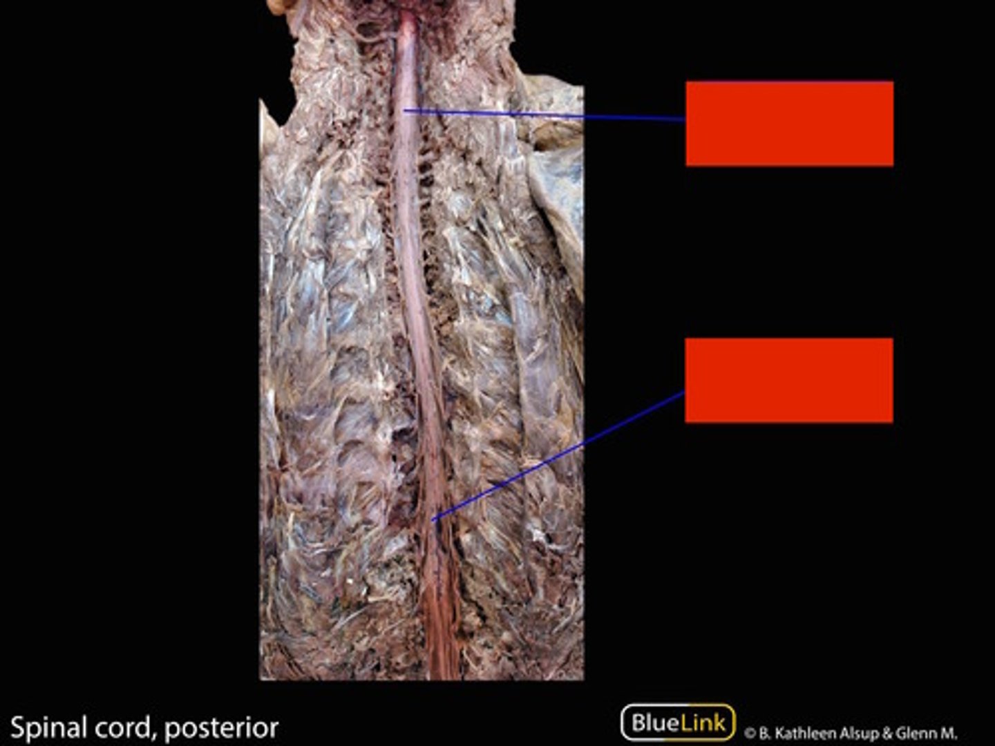 <p>(top cervical)</p><p>(bottom lumbrosacral)</p>