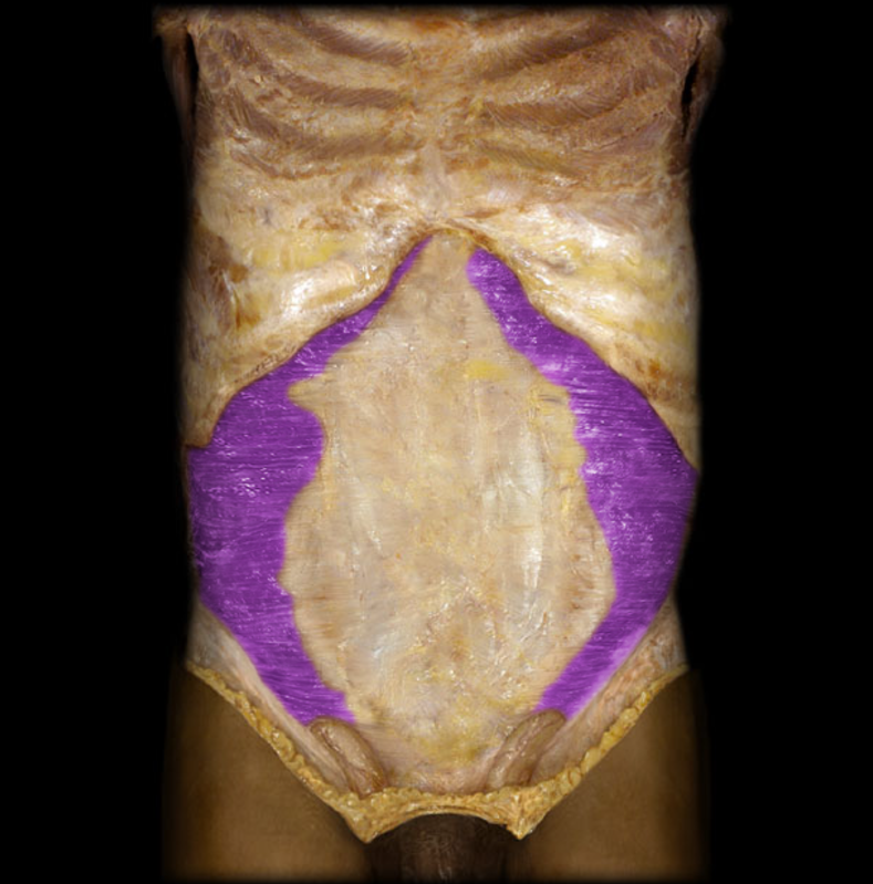 <p>Transverse abdomnial</p>