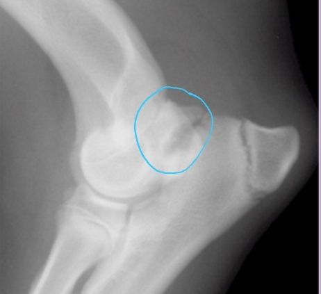 <p><span style="background-color: transparent;"><strong><span>Ununited Anconeal Process</span></strong></span></p>