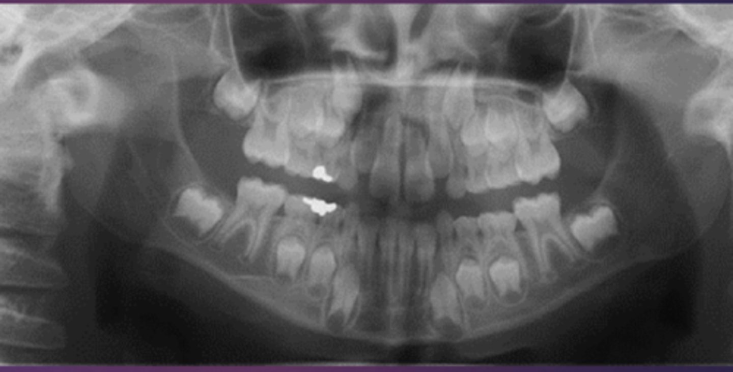 <p>Whats the age</p><p>5-6</p><p>7-8</p><p>9-10</p><p>11-12</p>