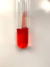 <p>What results can you gather from this tube?</p>