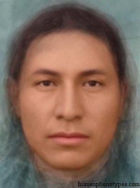 <p>Identify this Phenotype</p>