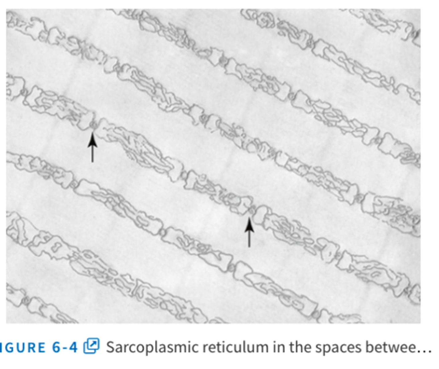 <p>specialized endoplasmic reticulum of skeletal muscle</p><p>in the sarcoplasm surrounding the myofibrils of each muscle fiber</p><p>special organization important in regulating calcium storage, release, reuptake, and therefore muscle contraction </p><p>The rapidly contracting types of muscle fibers have especially extensive sarcoplasmic reticula.</p>