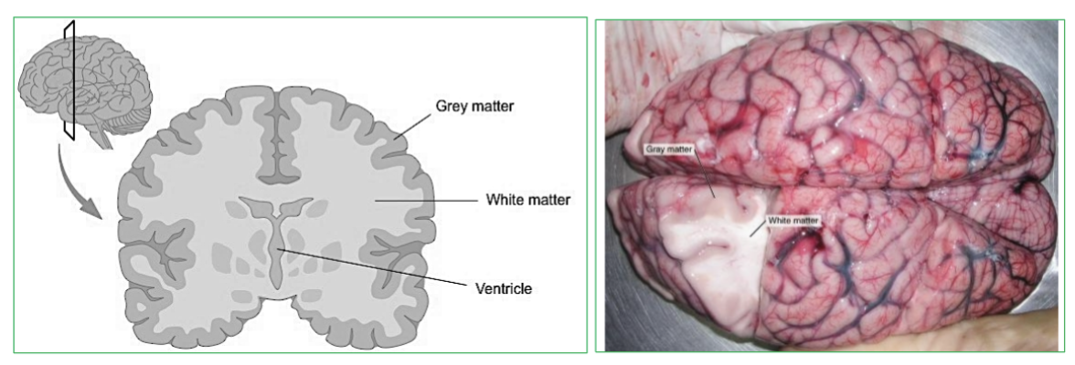 <p>Gray Matter.</p>