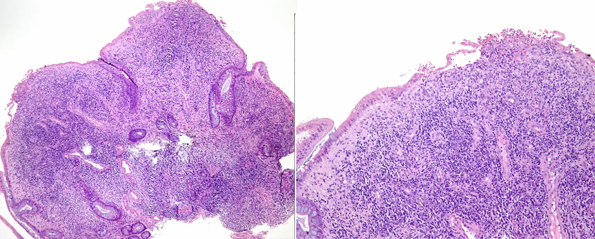 <p>Characterize this Polyp</p>