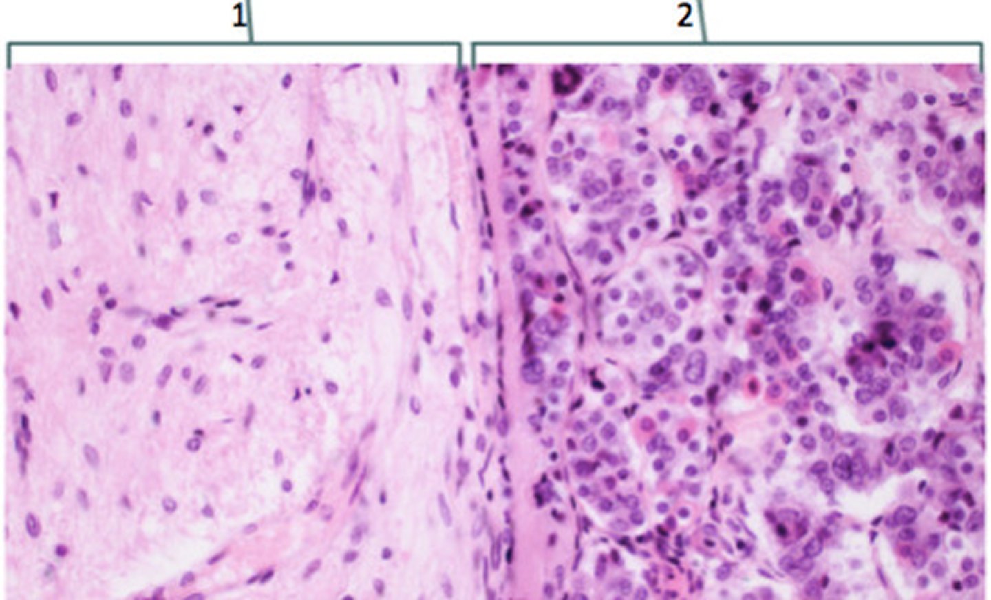 <p>What hormones are produced in areas 1 &amp; 2</p>