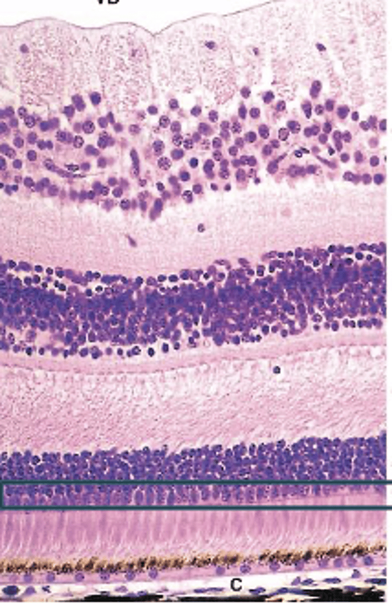 <p>Identify the Layers of the neural retina</p>