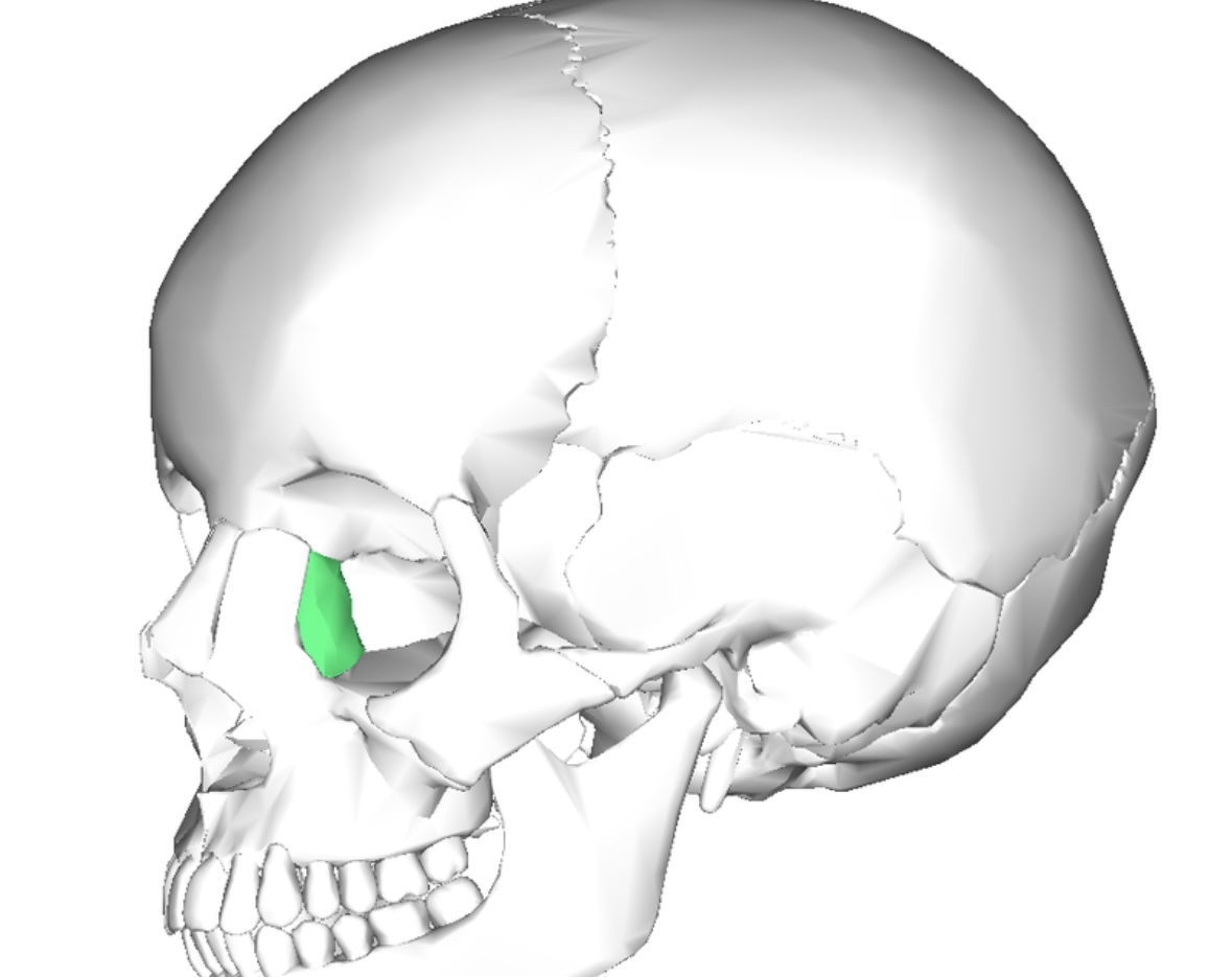 term image