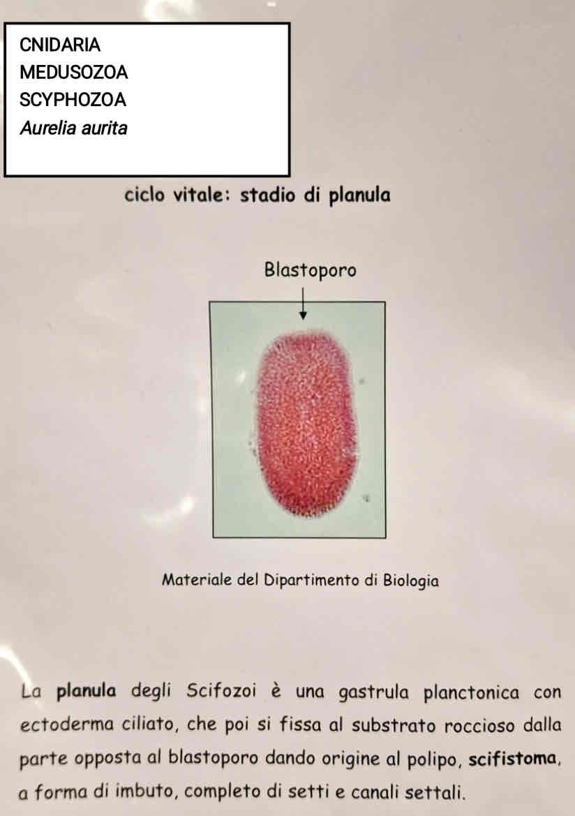 <p>Medusozoa</p><p>Scyphozoa</p><p><em>Aurelia aurita</em> (planula)</p>