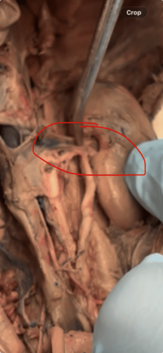 <p>vein: dumps out into the vena cava</p><p>artery: taking into heart</p>