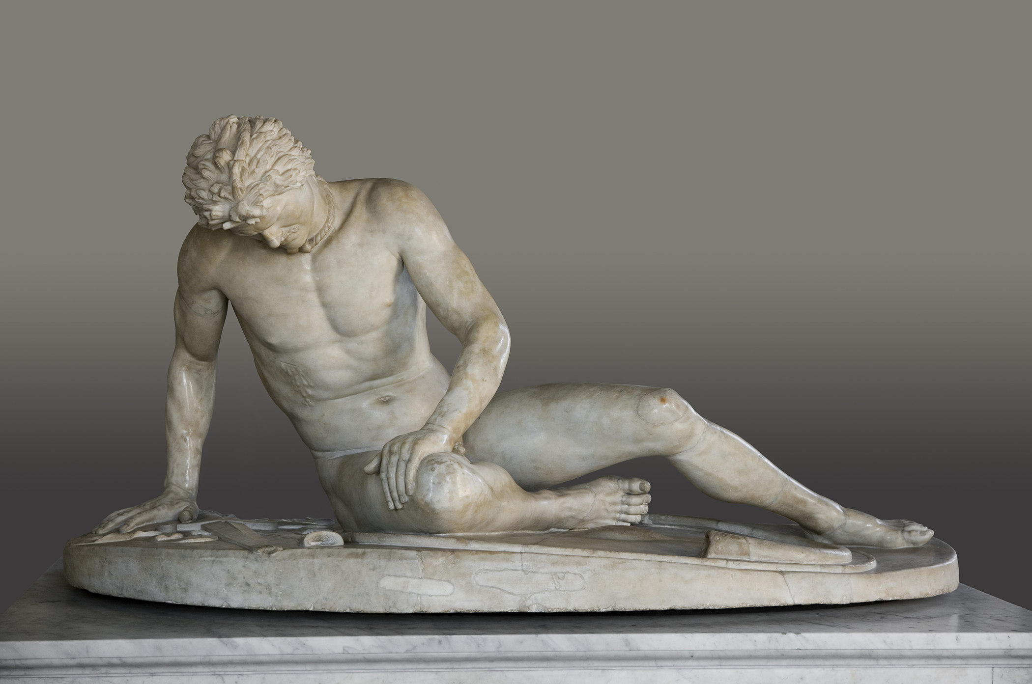 <p>The work shown can be attributed to the style of Hellenistic Greece because of which of the following characteristics?<br>A. The use of a canon of proportions to produce a perfected male form<br>B. The depiction of the psychological effects of defeat to elicit an emotional response from the viewer<br>C. The stylized treatment of the body to make it appropriate for use in a timeless funerary context<br>D. The inclusion of exaggerated signs of intense aging to foster respect for wisdom and experience</p>