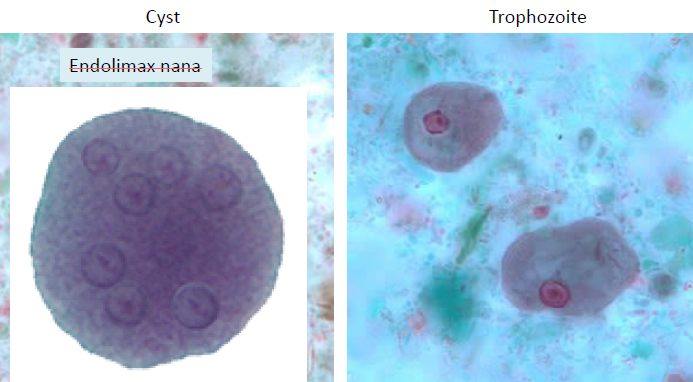 <p>Cyst</p><ul><li><p>8 nuclei</p></li><li><p>eccentric karyosome</p></li><li><p>10-35 micron</p></li></ul><p>Trophozoite</p><ul><li><p>1 nucleus</p></li><li><p>eccentric, large karyosome</p></li><li><p>dirty/vacuolated cytoplasm</p></li><li><p>15-50 micron</p></li></ul><p></p>
