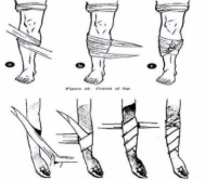 <p>What kind of bandage is this</p>