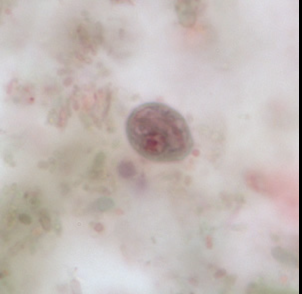 term image