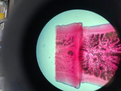 <p>What is the genus species of this tapeworm? Its definitive hosts are dogs and wild dogs, and its intermediate hosts are rabbits and rodents</p>