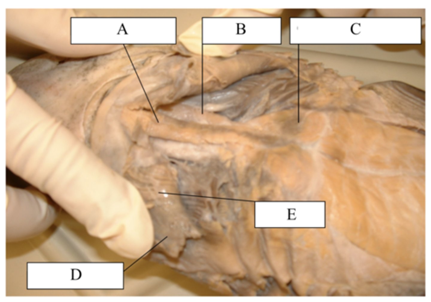 <p>What does letter C point to?</p>