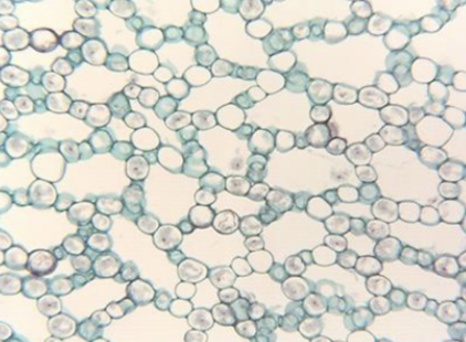 <p>Specialized Parenchyma</p><ul><li><p>Air cavities</p></li><li><p>Aquatic plants</p></li><li><p>Oxygen diffusion</p></li></ul><p></p>