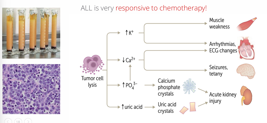 <p>-management: hydration, allopurinol, rasburicase</p>