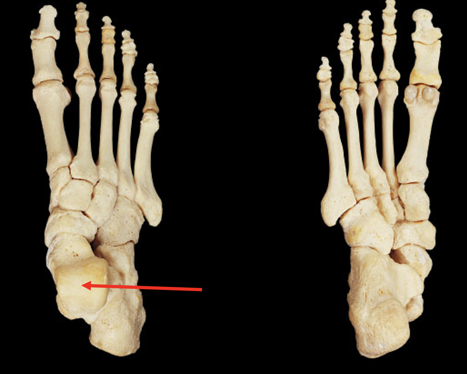 <p>Name this region of the foot</p>