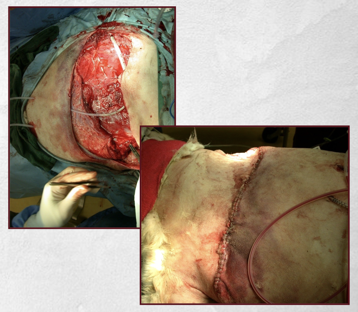 <p>-wound left open for 2-5 days</p><p>-closed prior to granulation tissue formation</p><p class="p1">-permits repeated lavage and debridement to convert wound to clean-contaminated status appropriate for closure</p>