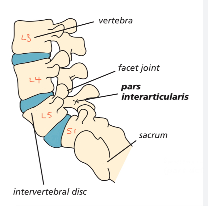 <ul><li><p>pars interarticularis </p></li><li><p>No transverse foramina, no costal pits </p></li></ul>