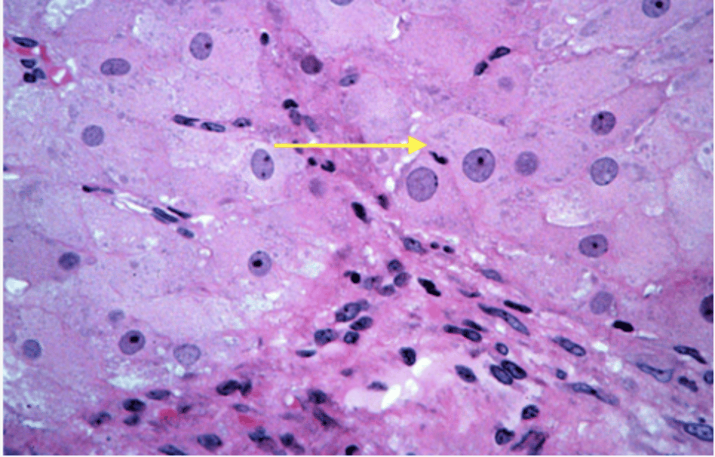 <p>Identify the cells</p>