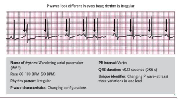 <p>an atrial rhythm that occurs when impulses arise from multiple areas, including the atria, the AV node, and the SA node; also called multiformed atrial rhythm</p>