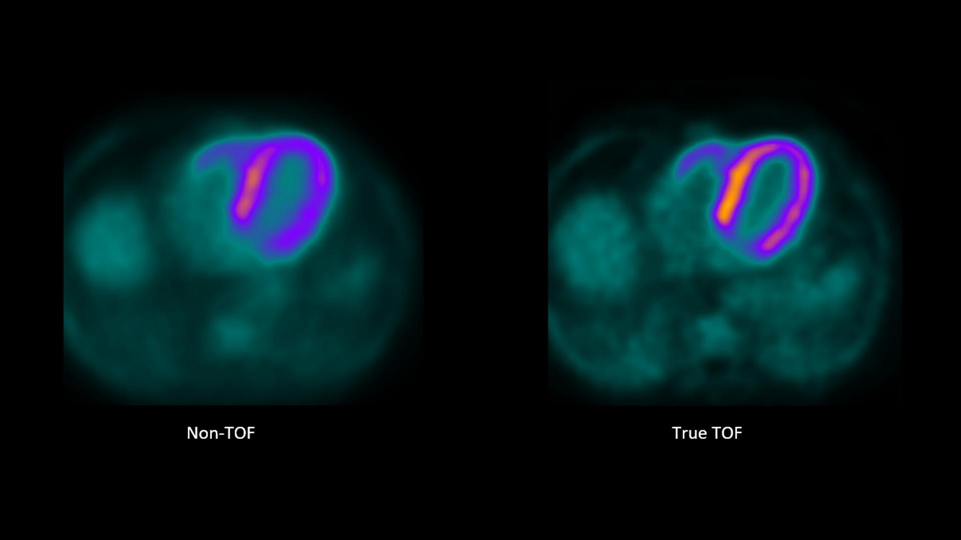 <p><span>How does <strong>time flight technology</strong> affect how we <em>dose</em> and image the patient in <strong>PET</strong>?</span></p>